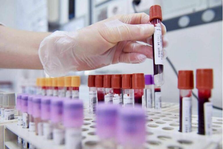 Dengue, un caso autoctono in Veneto. Salgono a 73 i casi di West Nile nel Lazio