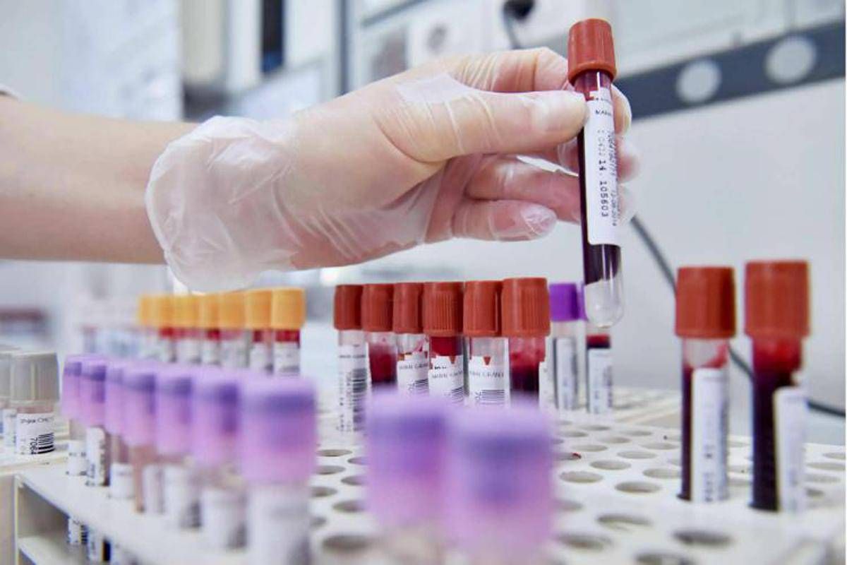Dengue, un caso autoctono in Veneto. Salgono a 73 i casi di West Nile nel Lazio