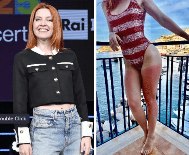 Dalla chioma alle gambe, Noemi ironizza sulla scottatura: “Mai senza crema”
