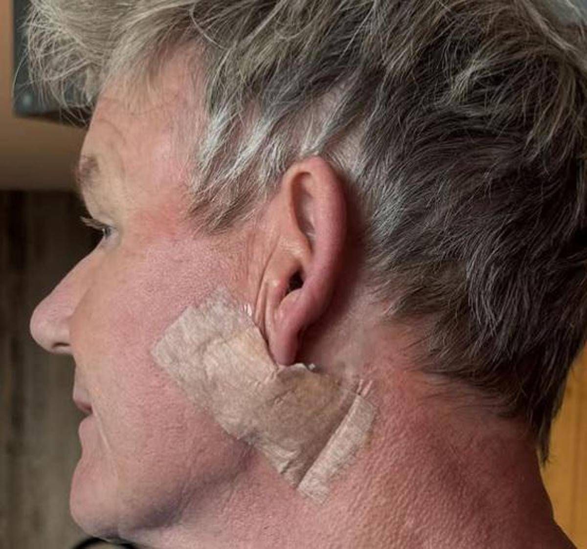 Gordon Ramsay: “Operato per tumore della pelle”