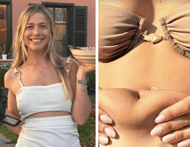 Ultimo, Jacqueline mostra la pancia a 8 mesi dal parto: “Amate il vostro corpo”
