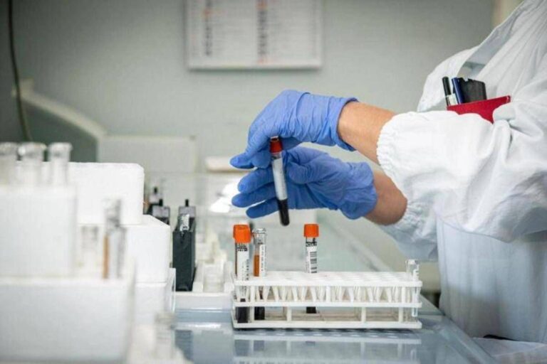 Epatite A, crescono i casi: sesso e alimenti, come si prende e sintomi