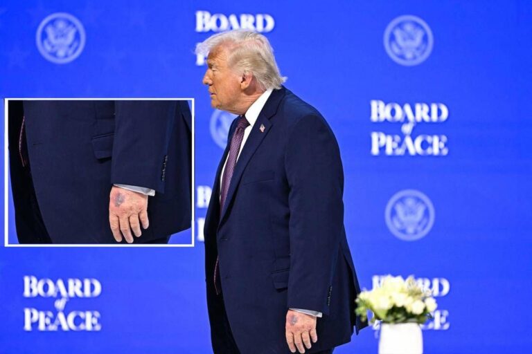 Trump, nuovo grande livido sul dorso della mano sinistra: il dettaglio non passa inosservato